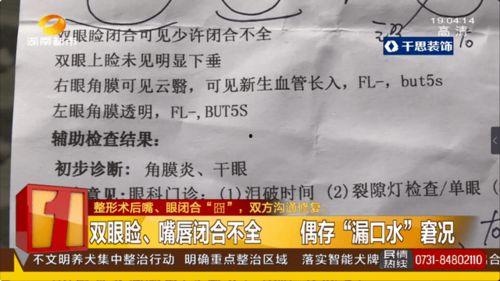 国外医生爆料案例最新,罕见病例揭示未知医疗挑战  第3张