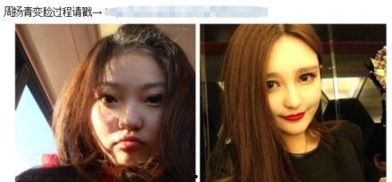 爆料小猪整容视频,揭秘网红变脸真相
