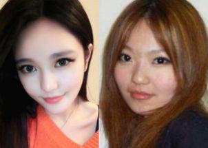 爆料小猪整容视频,揭秘网红变脸真相  第2张