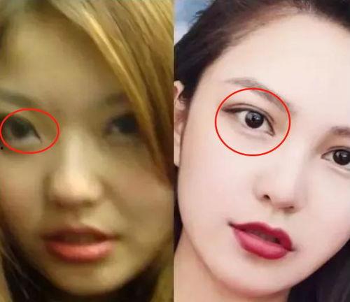 爆料小猪整容视频,揭秘网红变脸真相  第3张